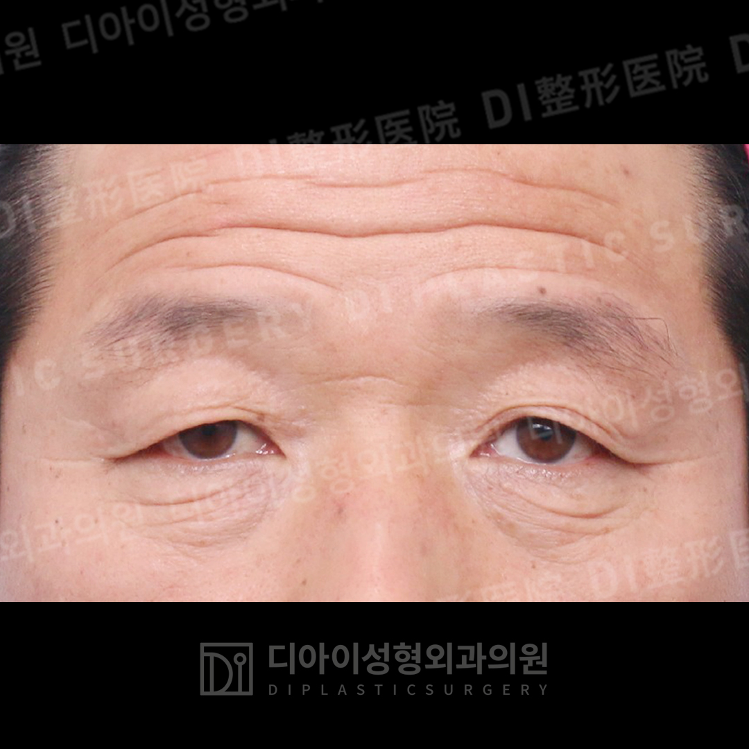 CASE 4 · Before