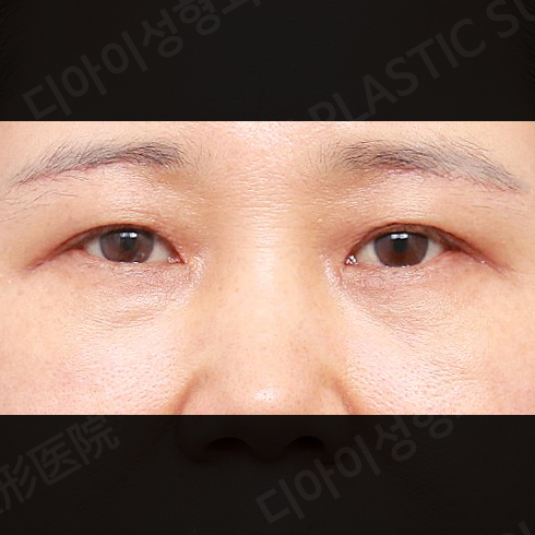 กรณี 5 · หลังทำ