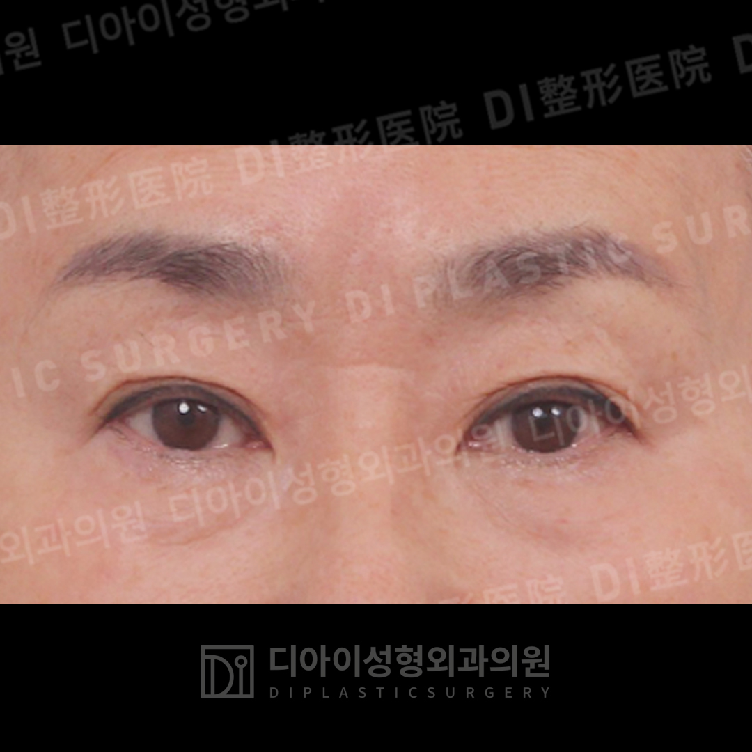 CASE 6 · Before