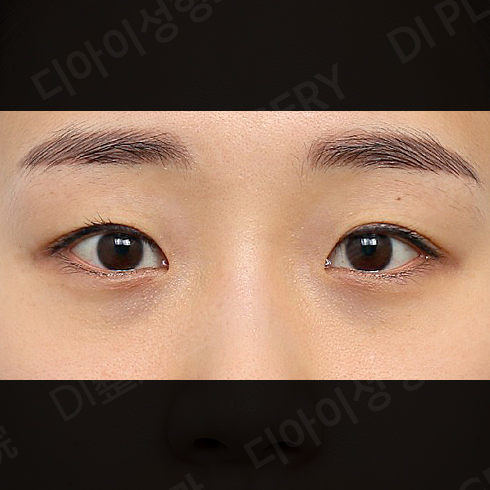 CASE 4 · Before