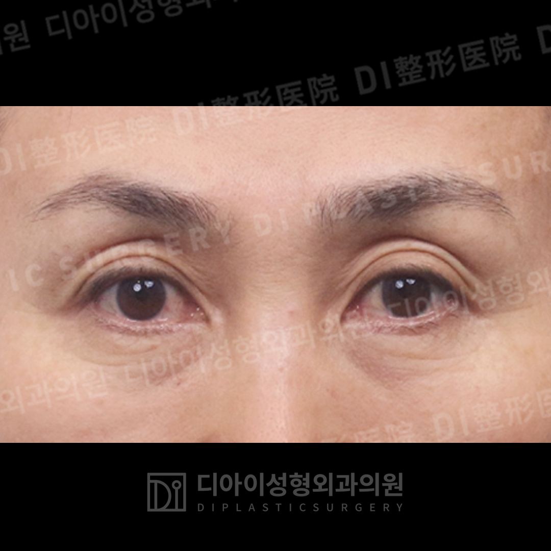 CASE 4 · Before