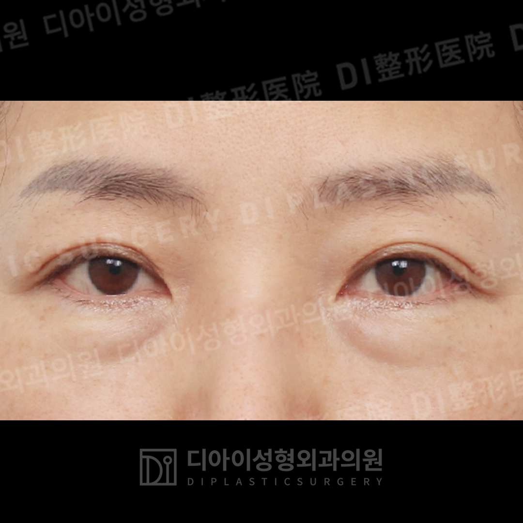 CASE 6 · Before