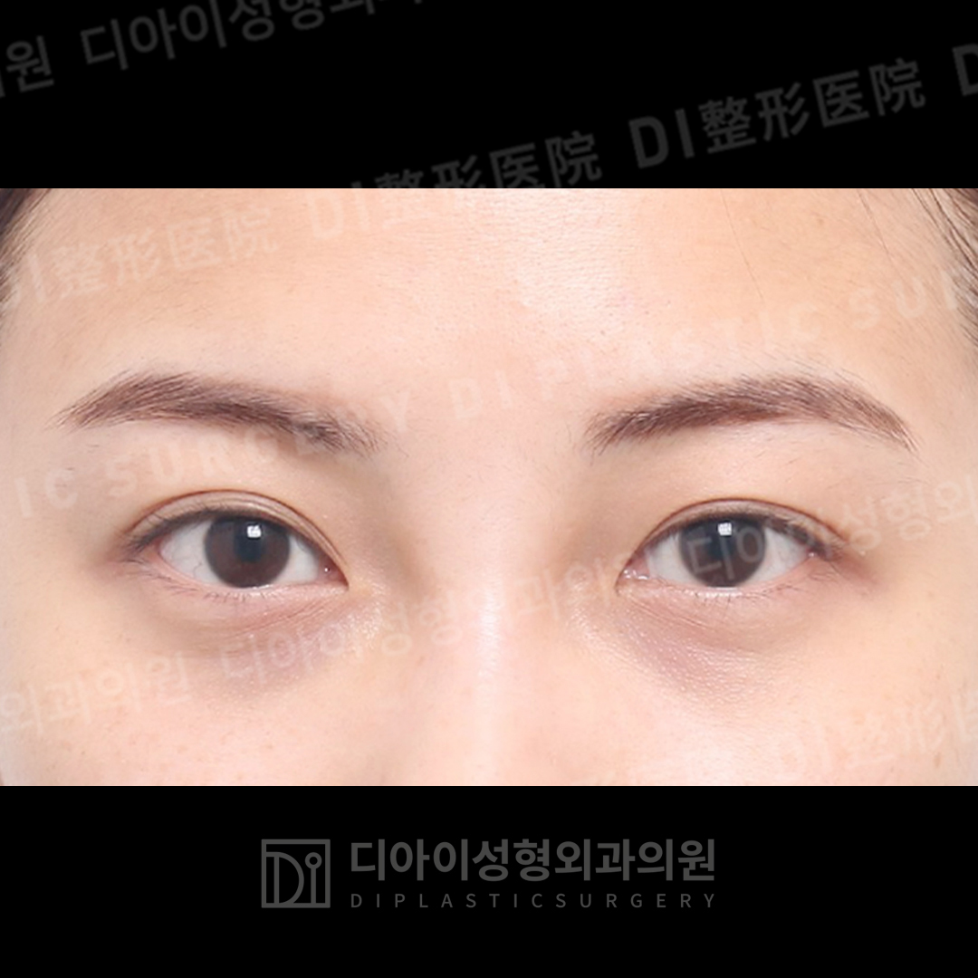 CASE 6 · Before