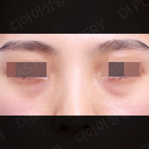 CASE 2 · Before