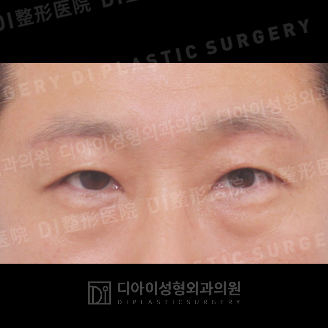 CASE 5 · After