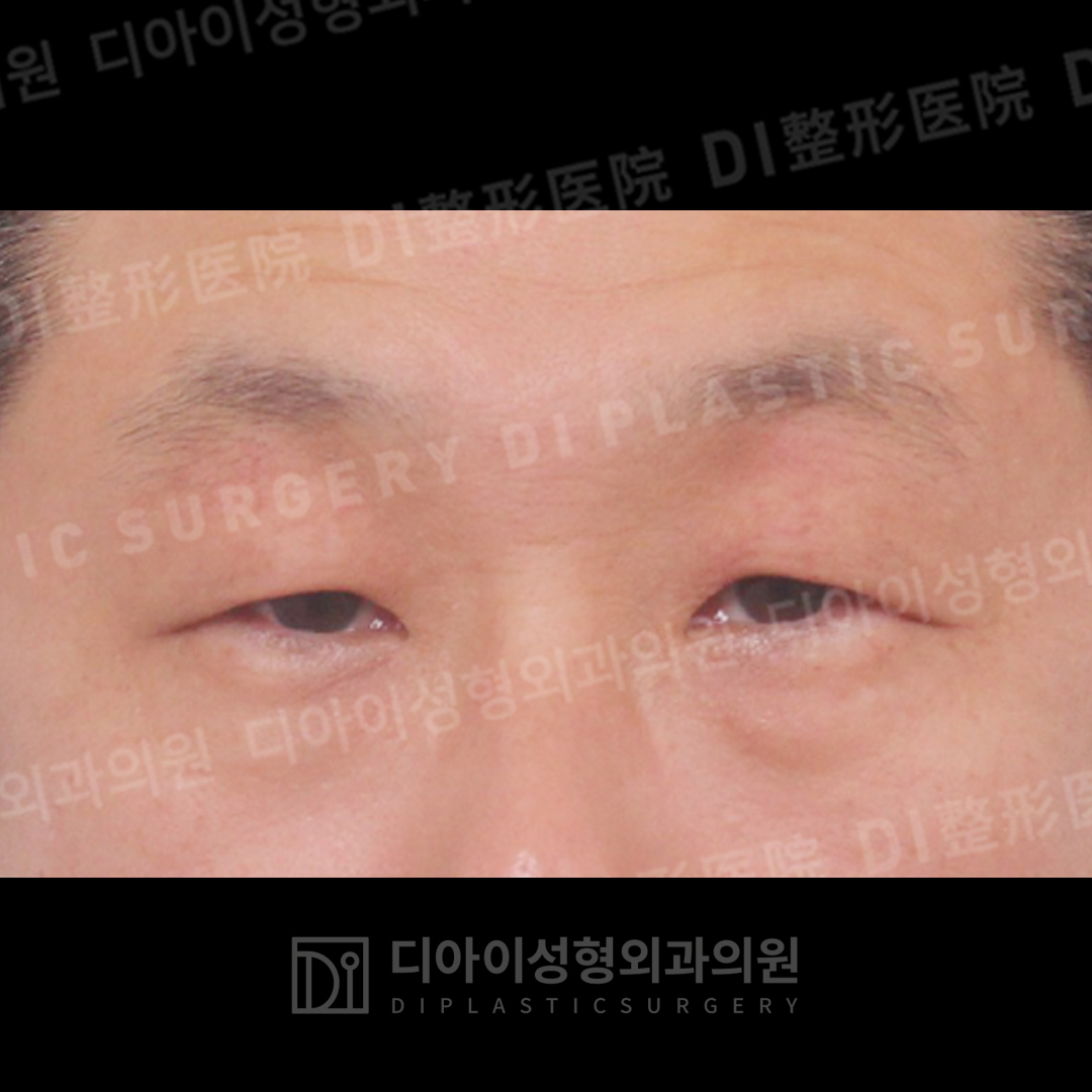 CASE 5 · Before