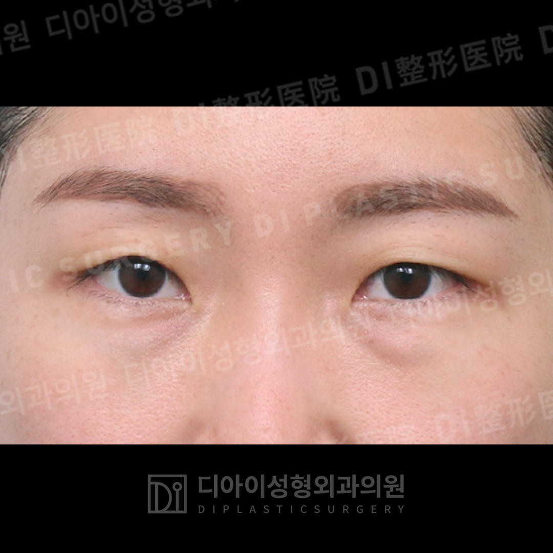 CASE 5 · Before