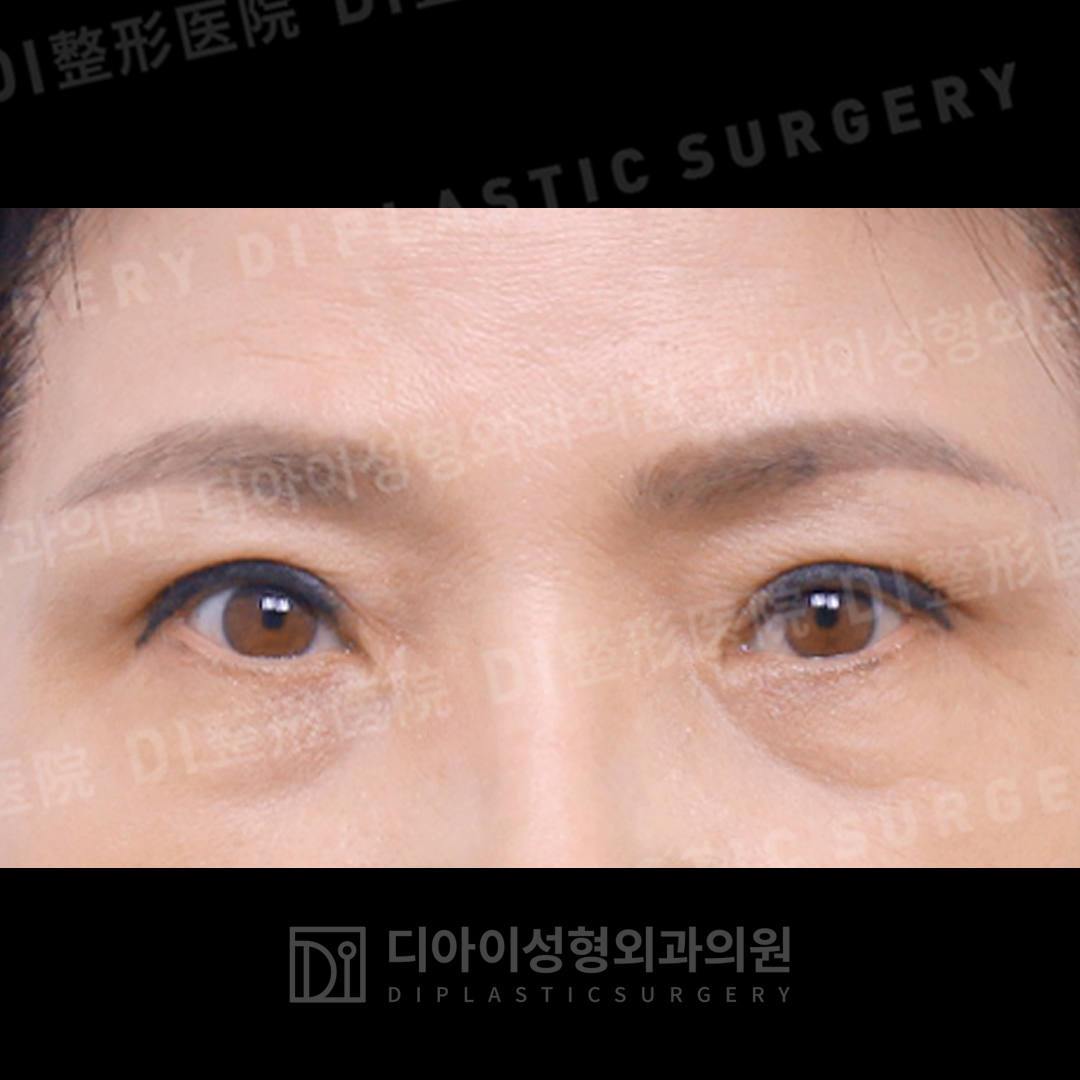 CASE 3 · After