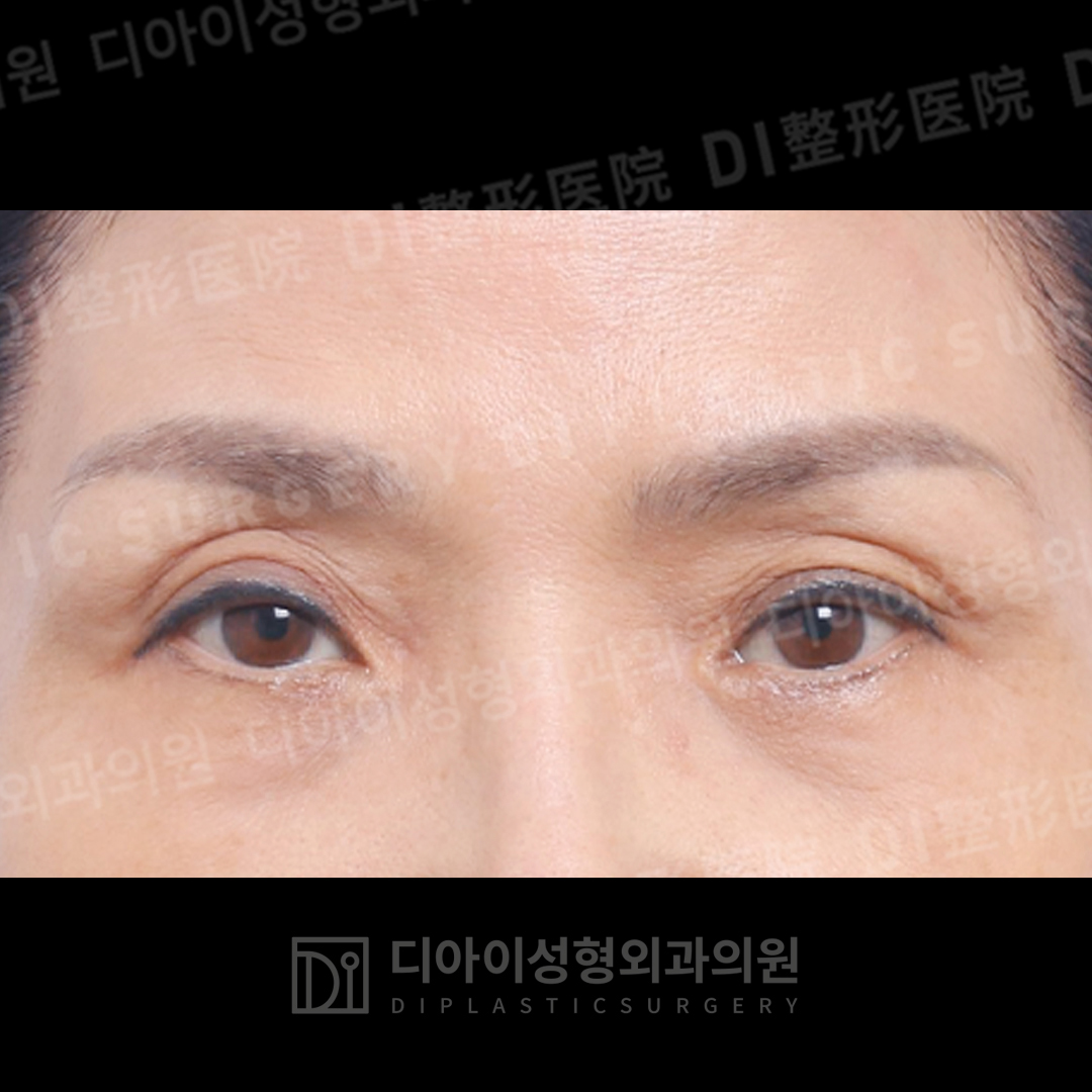 CASE 3 · Before