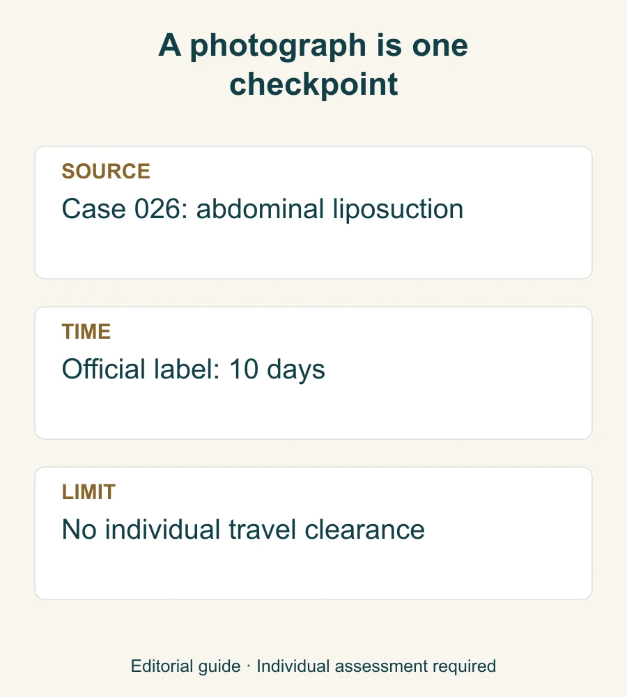 Three-part reading guide identifying the official abdominal liposuction case, its 10-day follow-up label and the limits of a photograph.