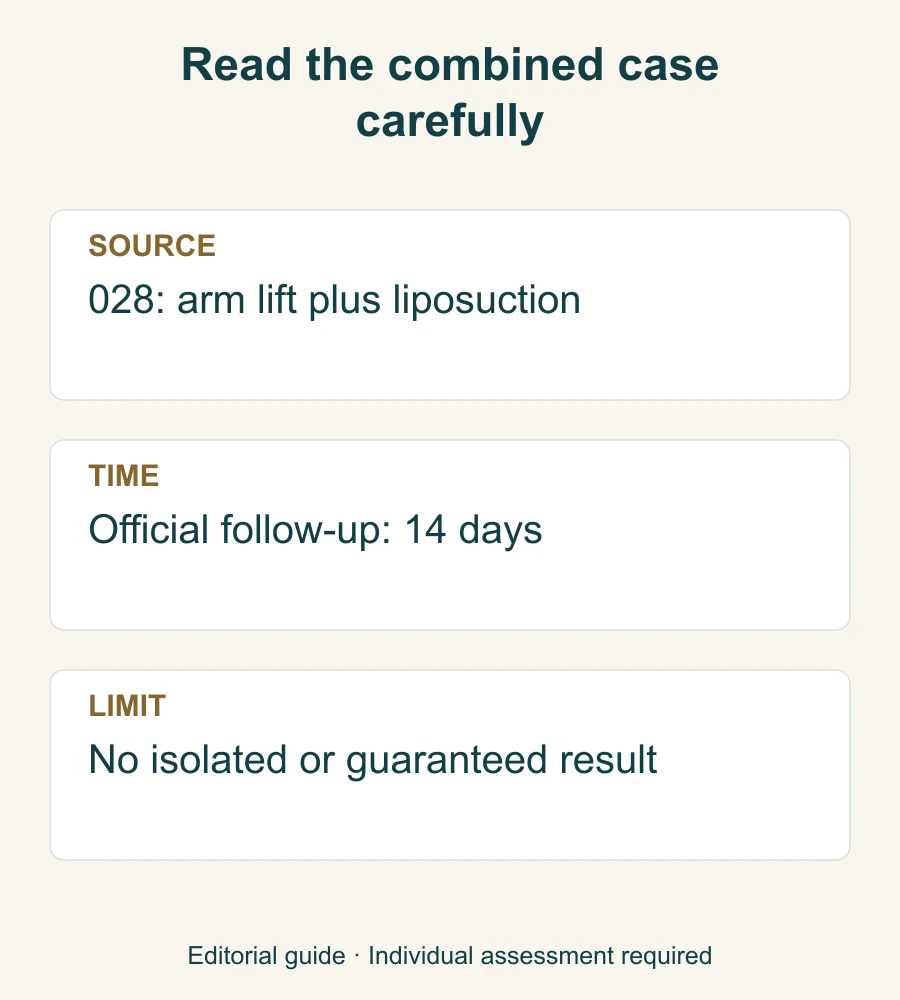 Source-reading card identifying the combined procedure and 14-day follow-up without promising a result.