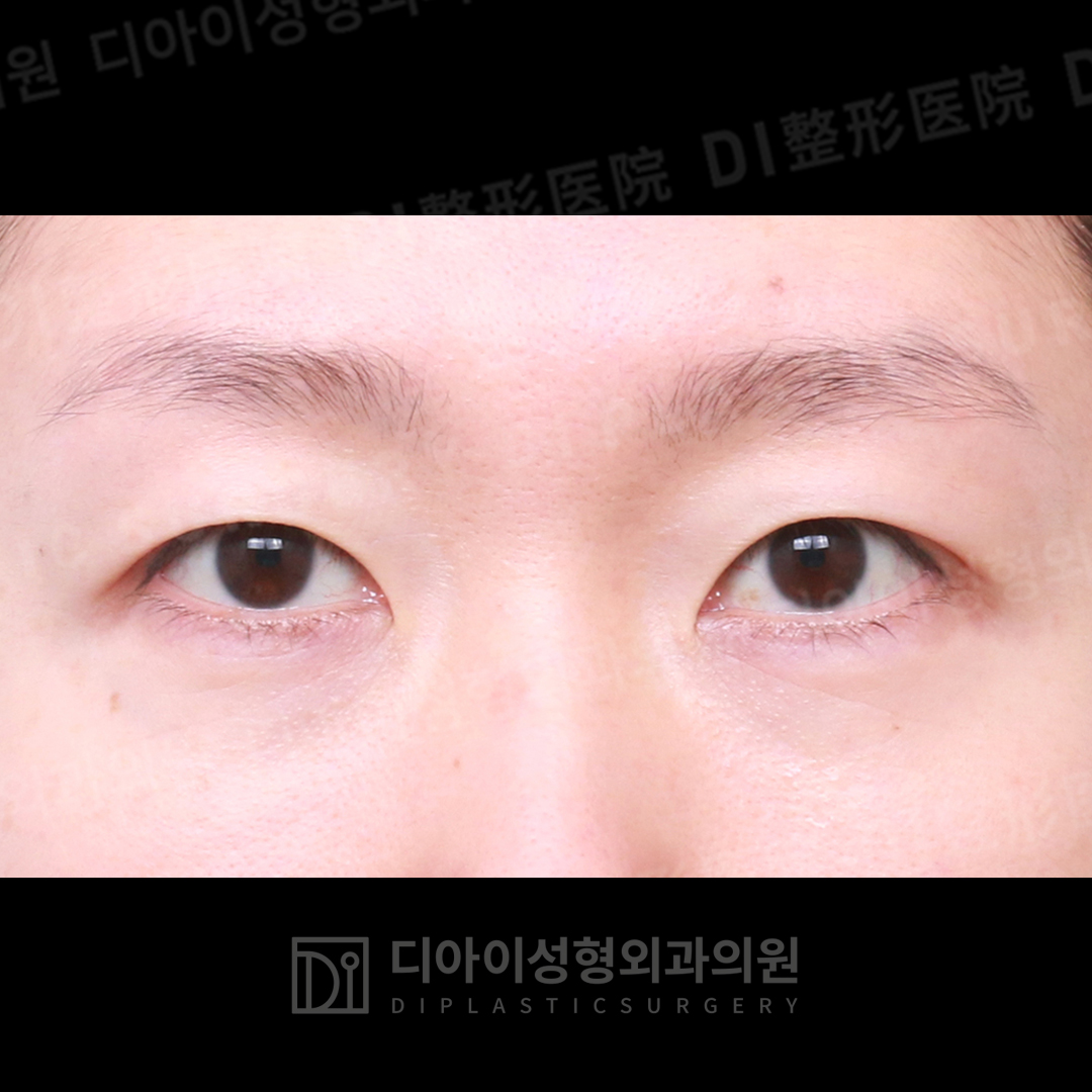 CASE 2 · After