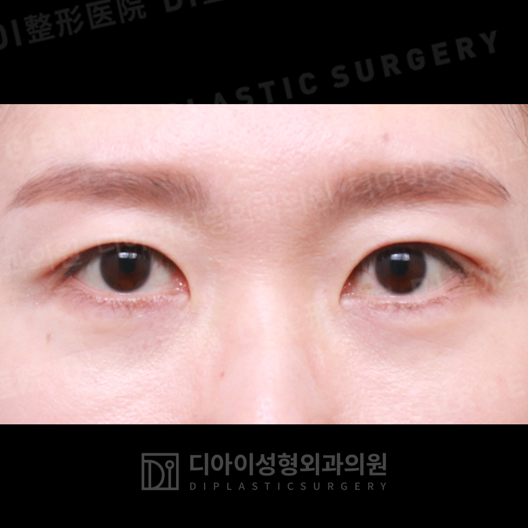 CASE 2 · Before