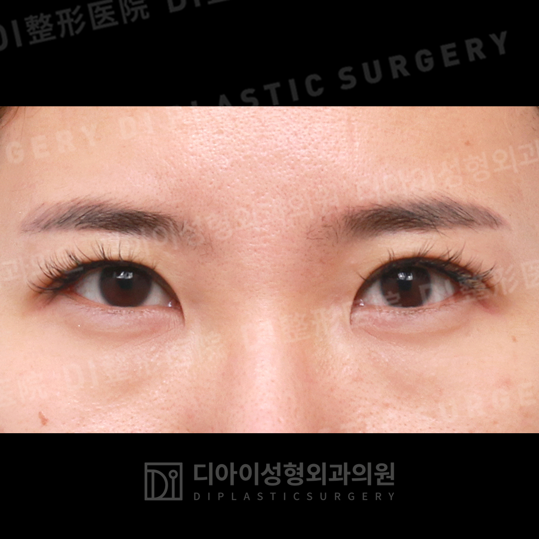 CASE 2 · Before