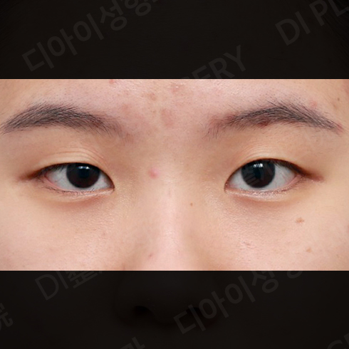 CASE 4 · Before