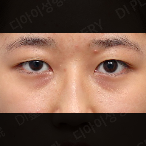 กรณี 4 · ก่อนทำ