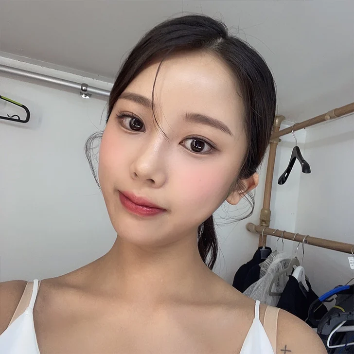 Canthoplasty