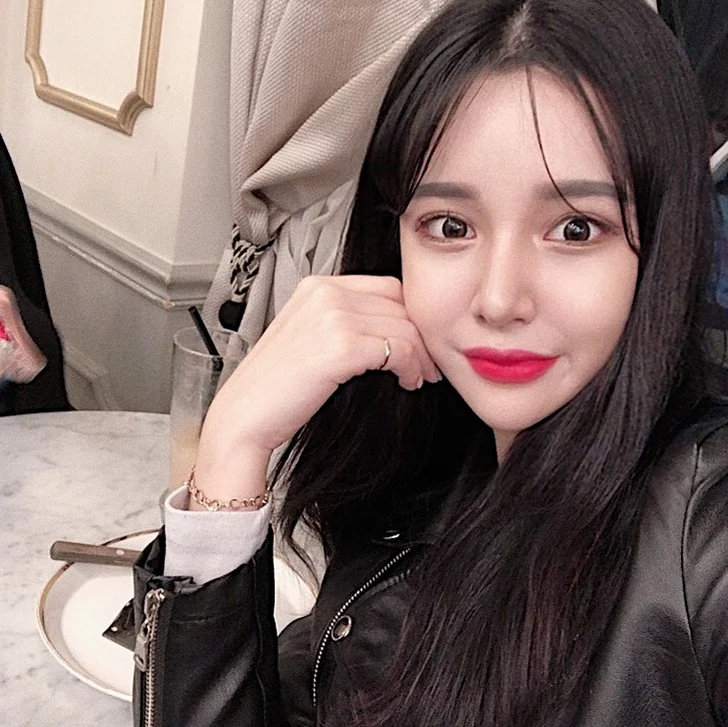Incisional Double Eyelid Surgery