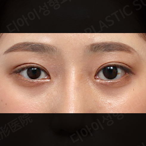CASE 3 · After