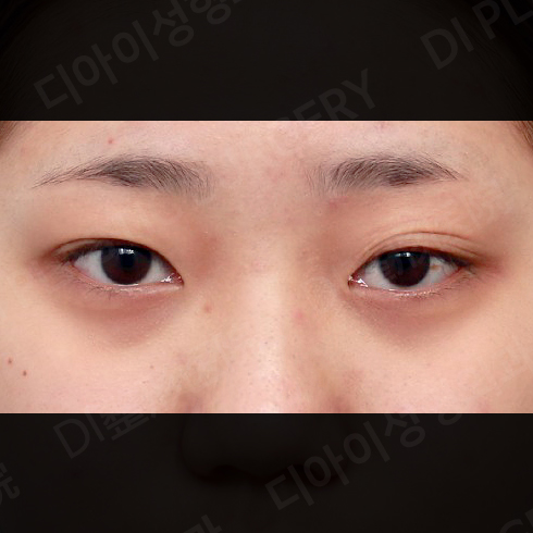 CASE 3 · Before