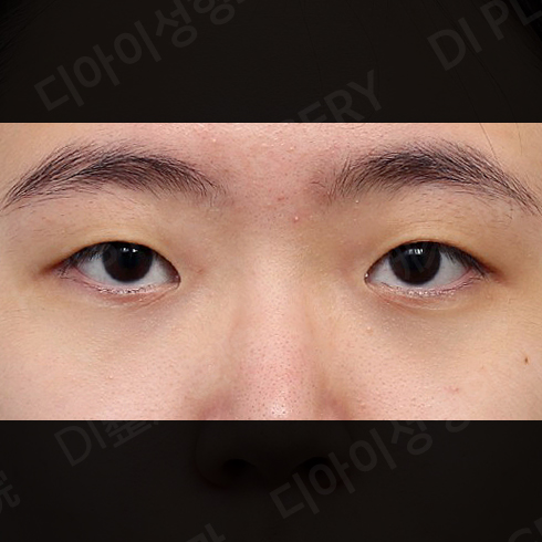 CASE 6 · Before