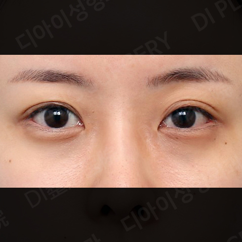 CASE 6 · Before