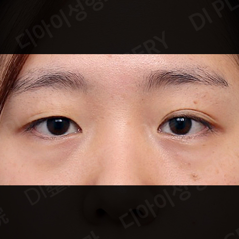 CASE 6 · Before
