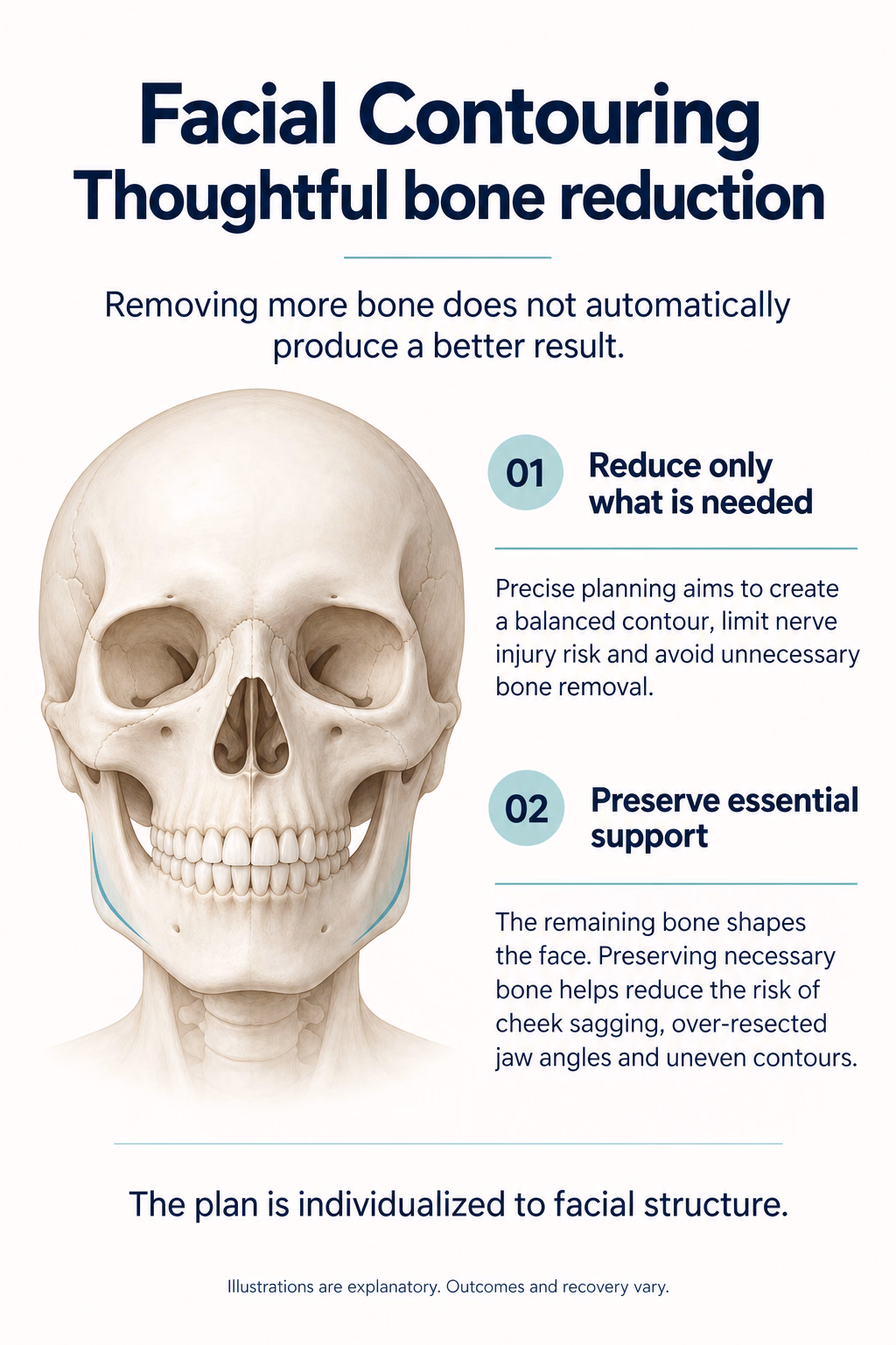 Facial Contouring
Thoughtful bone reduction
Removing more bone does not automatically produce a better result.
01  Reduce only what is needed
Precise planning aims to create a balanced contour, limit nerve injury risk and avoid unnecessary bone removal.
02  Preserve essential support
The remaining bone shapes the face. Preserving necessary bone helps reduce the risk of cheek sagging, over-resected jaw angles and uneven contours.
The plan is individualized to facial structure.
Illustrations are explanatory. Outcomes and recovery vary.