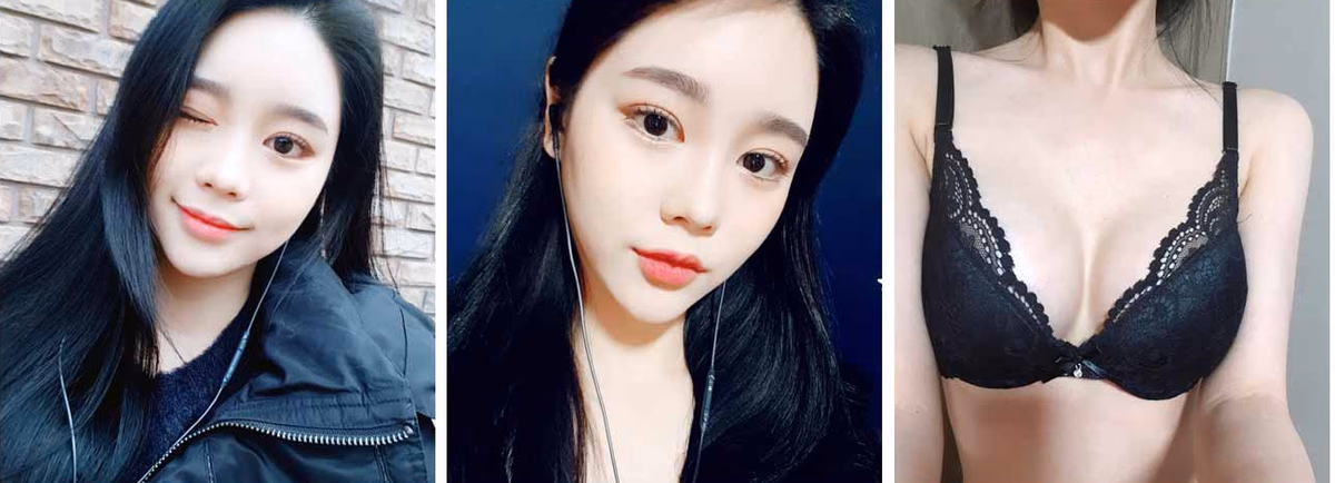 Suji — 6 months after surgery