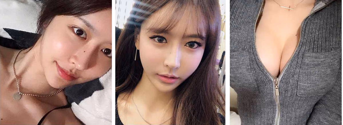 Haneul — หลังผ่าตัด 2 เดือน