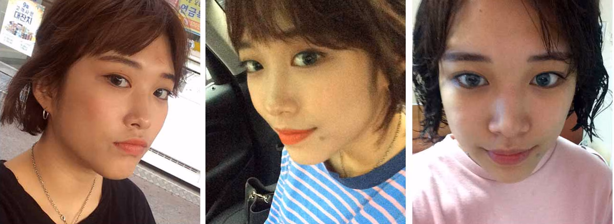 Sunmi — Before surgery