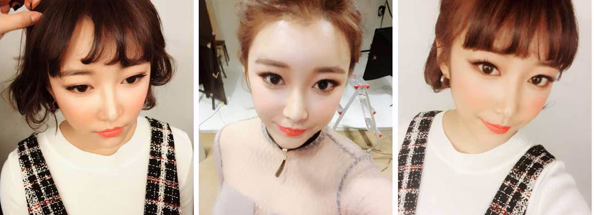 Sunmi — 3 months after surgery