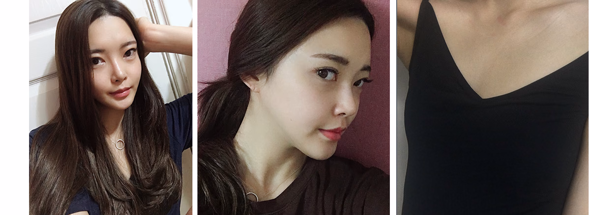 Cheonga — ก่อนผ่าตัด