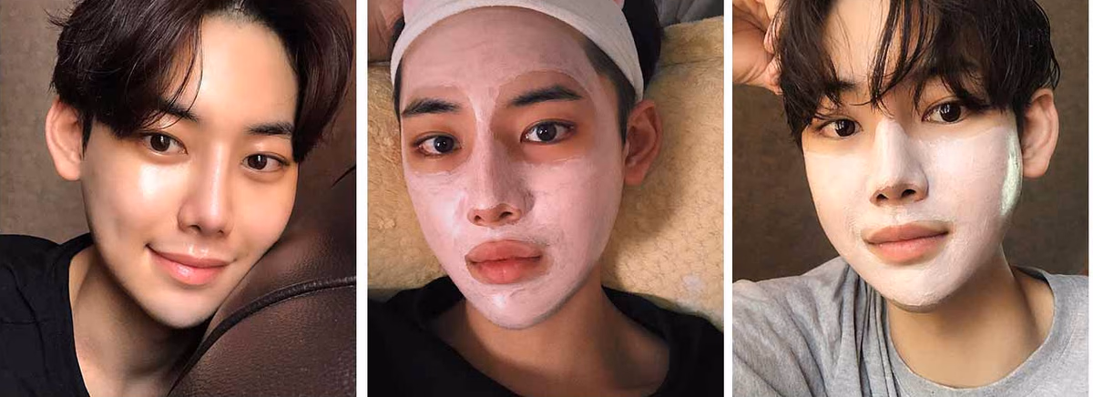 Eunwoo — 2 months after surgery
